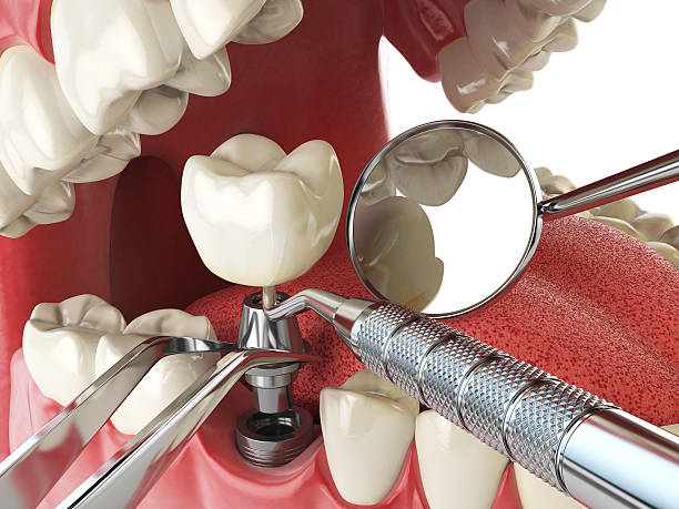 Best Same-Day Emergency Dentist in Polkton, NC